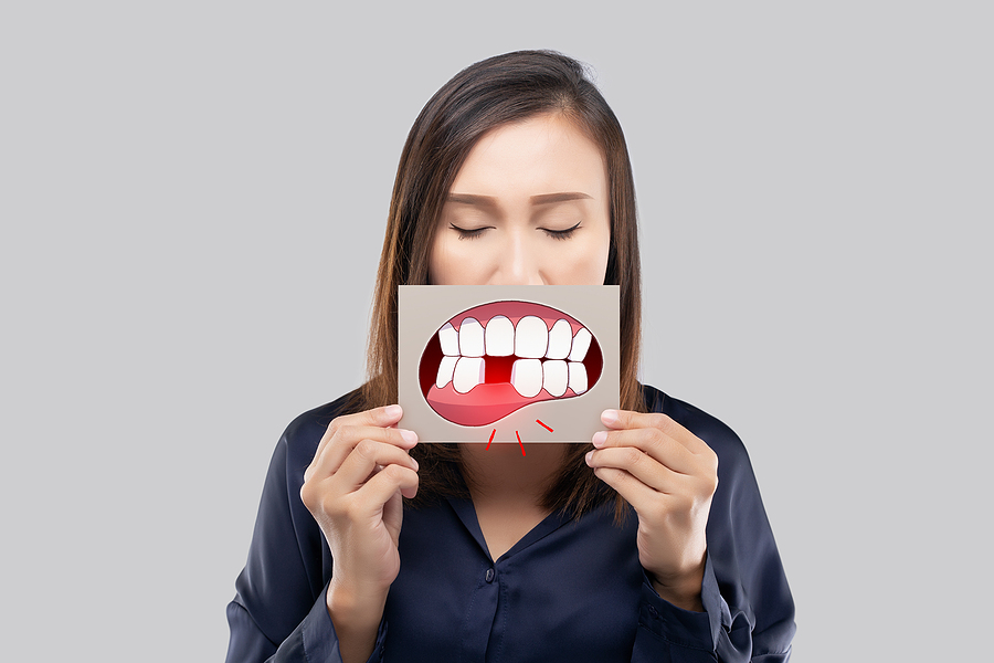 Replacement Options For Missing Teeth