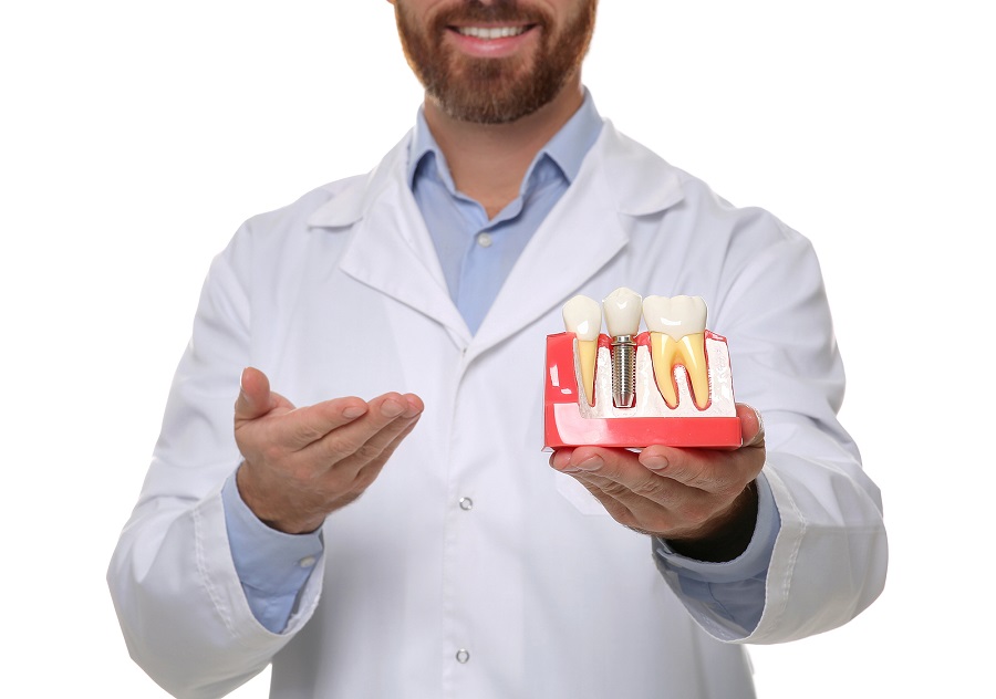 Dental Implants Are the Best Choice for Missing Teeth