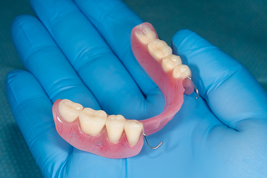 Restoring Smiles with Partial Dentures in Pensacola, FL