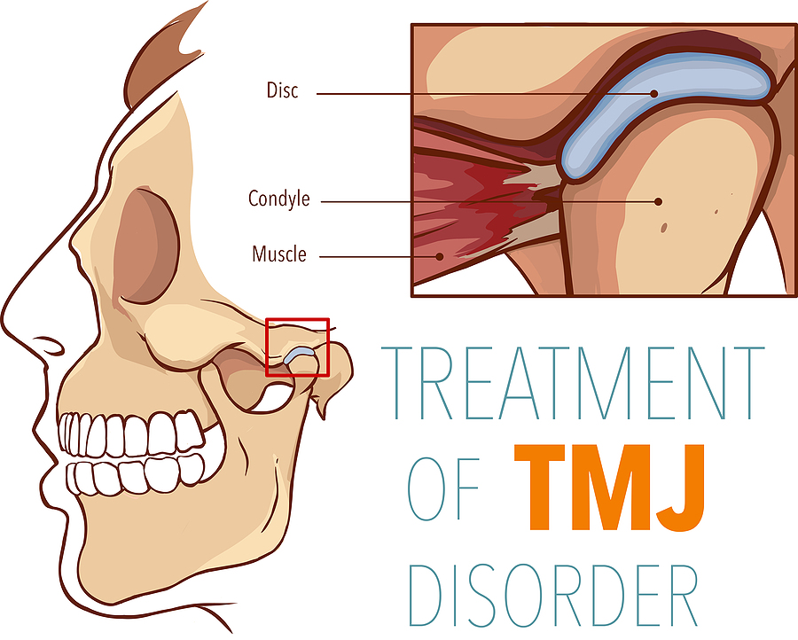 Understanding TMJ Treatments in Pensacola, FL: Causes, Symptoms, and Effective Solutions